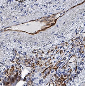 CRLR was detected in immersion fixed paraffin-embedded sections of human lung using Mouse Anti-Human CRLR Monoclonal Antibody (Catalog # MAB10044) at 5 µg/mL for 1 hour at room temperature followed by incubation with the Anti-Mouse IgG VisUCyte™ HRP Polymer Antibody (Catalog # VC001). Before incubation with the primary antibody, tissue was subjected to heat-induced epitope retrieval using Antigen Retrieval Reagent-Basic (Catalog # CTS013). Tissue was stained using DAB (brown) and counterstained with hematoxylin (blue). Specific staining was localized to cytoplasm in endothelial cells. View our protocol for IHC Staining with VisUCyte HRP Polymer Detection Reagents.