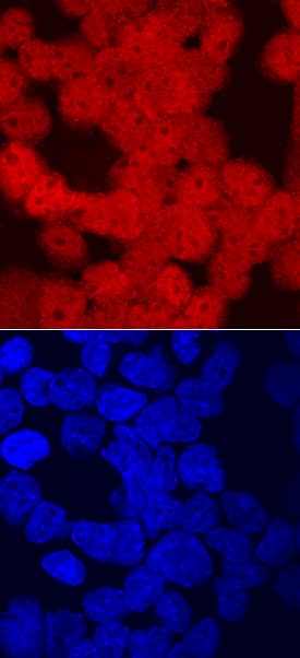 Immunocytochemistry CRX/CORD2 Antibody [Unconjugated]