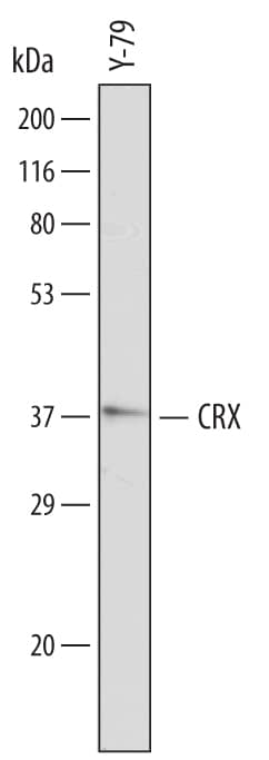 Western Blot CRX/CORD2 Antibody [Unconjugated]