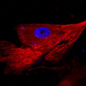 Immunocytochemistry C-Reactive Protein/CRP Antibody [Unconjugated]