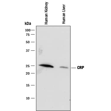Western Blot C-Reactive Protein/CRP Antibody [Unconjugated]
