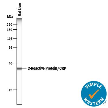 Simple Western C-Reactive Protein/CRP Antibody [Unconjugated]