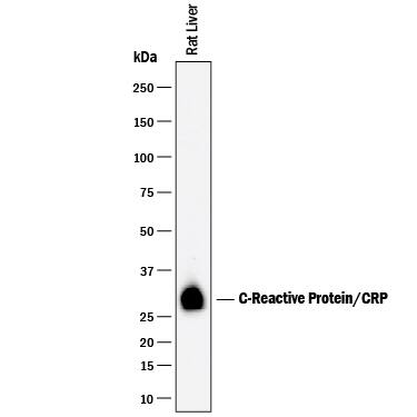 Western Blot C-Reactive Protein/CRP Antibody [Unconjugated]