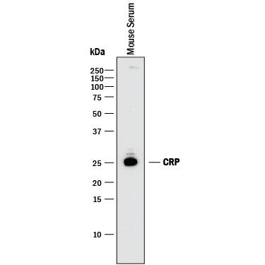 Western Blot C-Reactive Protein/CRP Antibody [Unconjugated]