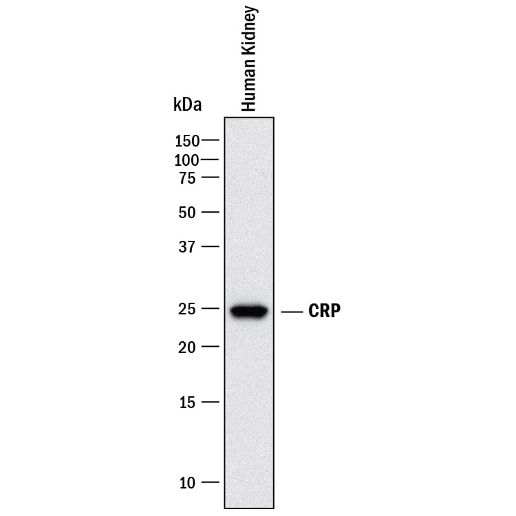 Western blot shows lysates of human kidney tissue. PVDF membrane was probed with 2 µg/mL of Mouse Anti-Human C-Reactive Protein/CRP Monoclonal Antibody (Catalog # MAB17074) followed by HRP-conjugated Anti-Mouse IgG Secondary Antibody (Catalog # HAF018). A specific band was detected for C-Reactive Protein/CRP at approximately 25 kDa (as indicated). This experiment was conducted under reducing conditions and using Immunoblot Buffer Group 1.