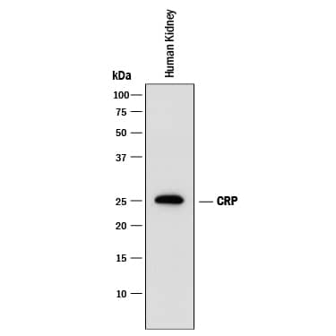 Western blot shows lysates of human kidney tissue. PVDF membrane was probed with 0.5 µg/mL of Mouse Anti-Human/Mouse/Porcine C-Reactive Protein/CRP Monoclonal Antibody (Catalog # MAB1707) followed by HRP-conjugated Anti-Mouse IgG Secondary Antibody (Catalog # HAF018). A specific band was detected for C-Reactive Protein/CRP at approximately 25 kDa (as indicated). This experiment was conducted under reducing conditions and using Immunoblot Buffer Group 1.