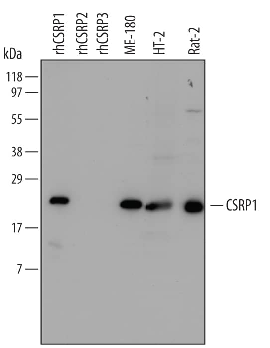 Western Blot CSRP1 Antibody