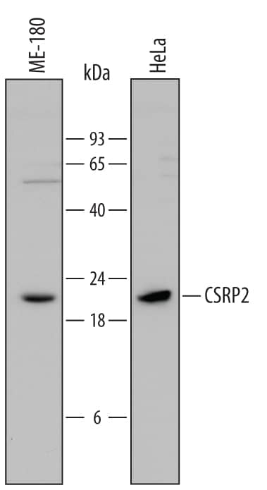 Western blot shows lysates of ME-180 human cervical epithelial carcinoma cell line and HeLa human cervical epithelial carcinoma cell line. PVDF Membrane was probed with 2 µg/mL of Goat Anti-Human CSRP2 Antigen Affinity-purified Polyclonal Antibody (Catalog # AF6196) followed by HRP-conjugated Anti-Goat IgG Secondary Antibody (Catalog # HAF109). A specific band was detected for CSRP2 at approximately 21 kDa (as indicated). This experiment was conducted under reducing conditions and using Immunoblot Buffer Group 1.