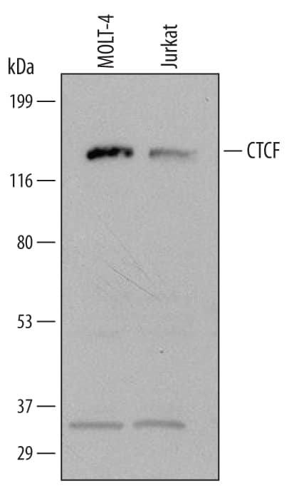 Western blot shows lysates of MOLT-4 human acute lymphoblastic leukemia cell line and Jurkat human acute T cell leukemia cell line. PVDF Membrane was probed with 1 µg/mL of Sheep Anti-Human CTCF Antigen Affinity-purified Polyclonal Antibody (Catalog # AF6369) followed by HRP-conjugated Anti-Sheep IgG Secondary Antibody (Catalog # HAF016). A specific band was detected for CTCF at approximately 130 kDa (as indicated). This experiment was conducted under reducing conditions and using Immunoblot Buffer Group 1.