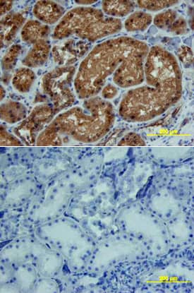 CTGF/CCN2 was detected in immersion fixed paraffin-embedded sections of human kidney array using Goat Anti-Human CTGF/CCN2 C-Terminus Antigen Affinity-purified Polyclonal Antibody (Catalog # AF660) at 15 µg/mL overnight at 4 °C. Tissue was stained using the Anti-Goat HRP-DAB Cell & Tissue Staining Kit (brown; Catalog # CTS008) and counterstained with hematoxylin (blue). Lower panel shows a lack of labeling if primary antibodies are omitted and tissue is stained only with secondary antibody followed by incubation with detection reagents. View our protocol for Chromogenic IHC Staining of Paraffin-embedded Tissue Sections.