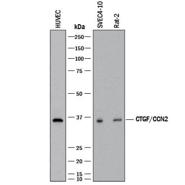 Western blot shows lysates of HUVEC human umbilical vein endothelial cells, SVEC4-10 mouse vascular endothelial cell line, and Rat-2 rat embryonic fibroblast cell line. PVDF membrane was probed with 2 µg/mL of Rabbit Anti-Human/Mouse/Rat CTGF/CCN2 Monoclonal Antibody (Catalog # MAB91901) followed by HRP-conjugated Anti-Rabbit IgG Secondary Antibody (Catalog # HAF008). A specific band was detected for CTGF/CCN2 at approximately 36 kDa (as indicated). This experiment was conducted under reducing conditions and using Immunoblot Buffer Group 1.