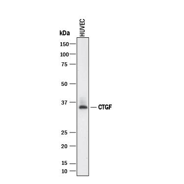 Western blot shows lysates of HUVEC human umbilical vein endothelial cells. PVDF membrane was probed with 2 µg/mL of Mouse Anti-Human CTGF/CCN2 Monoclonal Antibody (Catalog # MAB9190) followed by HRP-conjugated Anti-Mouse IgG Secondary Antibody (Catalog # HAF018). A specific band was detected for CTGF/CCN2 at approximately 35 kDa (as indicated). This experiment was conducted under reducing conditions and using Immunoblot Buffer Group 1.