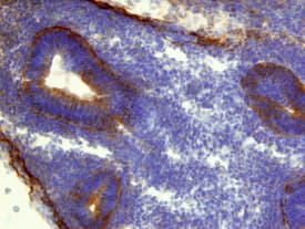 Immunohistochemistry CTHRC1 Antibody [Unconjugated]