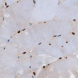 Immunohistochemistry CUGBP1/CELF1 Antibody (850717) [Unconjugated]