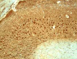 Immunohistochemistry CX3CL1/Fractalkine Antibody [Unconjugated]
