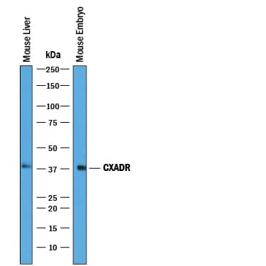 Western Blot CXADR Antibody [Unconjugated]