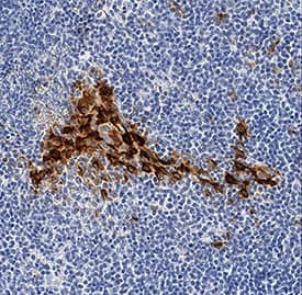 Immunohistochemistry CXCL10/IP-10/CRG-2 Antibody [Unconjugated]