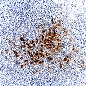 CXCL10/IP-10/CRG-2 was detected in immersion fixed paraffin-embedded sections of human tonsil using Mouse Anti-Human CXCL10/IP-10/CRG-2 Monoclonal Antibody (Catalog # MAB2662) at 5 µg/mL for 1 hour at room temperature followed by incubation with the Anti-Mouse IgG VisUCyte™ HRP Polymer Antibody (Catalog # VC001). Before incubation with the primary antibody, tissue was subjected to heat-induced epitope retrieval using Antigen Retrieval Reagent-Basic (Catalog # CTS013). Tissue was stained using DAB (brown) and counterstained with hematoxylin (blue). Specific staining was localized to cytoplasm in endothelial cells. View our protocol for IHC Staining with VisUCyte HRP Polymer Detection Reagents.