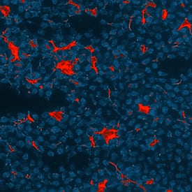 CXCL13/BLC/BCA-1 was detected in perfusion fixed frozen sections of mouse intestine (Peyer's patch) using Goat Anti-Mouse CXCL13/BLC/BCA-1 Antigen Affinity-purified Polyclonal Antibody (Catalog # AF470) at 15 µg/mL overnight at 4 °C. Tissue was stained using the NorthernLights™ 557-conjugated Anti-Goat IgG Secondary Antibody (red; Catalog # NL001) and counterstained with DAPI (blue). Specific staining was localized to endothelial cells. View our protocol for Fluorescent IHC Staining of Frozen Tissue Sections.