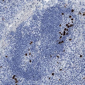 CXCL13/BLC/BCA-1 was detected in immersion fixed paraffin-embedded sections of human tonsil using Mouse Anti-Human CXCL13/BLC/BCA-1 Monoclonal Antibody (Catalog # MAB8012) at 1.7 µg/mL for 1 hour at room temperature followed by incubation with the Anti-Mouse IgG VisUCyte™ HRP Polymer Antibody VC001). Before incubation with the primary antibody, tissue was subjected to heat-induced epitope retrieval using Antigen Retrieval Reagent-Basic (CTS013). Tissue was stained using DAB (brown) and counterstained with hematoxylin (blue). Specific staining was localized to cytoplasm. View our protocol for IHC Staining with VisUCyte HRP Polymer Detection Reagents.