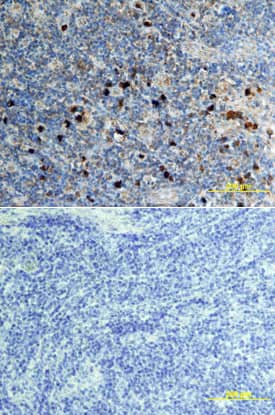 CXCL16 was detected in immersion fixed paraffin-embedded sections of human lymphoma using Goat Anti-Human/Primate CXCL16 Antigen Affinity-purified Polyclonal Antibody (Catalog # AF976) at 15 µg/mL overnight at 4 °C. Tissue was stained using the Anti-Goat HRP-DAB Cell & Tissue Staining Kit (brown; Catalog # CTS008) and counterstained with hematoxylin (blue). Lower panel shows a lack of labeling if primary antibodies are omitted and tissue is stained only with secondary antibody followed by incubation with detection reagents. View our protocol for Chromogenic IHC Staining of Paraffin-embedded Tissue Sections.