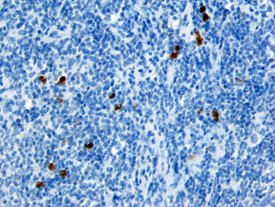 CXCL16 was detected in immersion fixed paraffin-embedded sections of human lymph node using Goat Anti-Human/Primate CXCL16 Antigen Affinity-purified Polyclonal Antibody (Catalog # AF976) at 10 µg/mL overnight at 4 °C. Before incubation with the primary antibody tissue was subjected to heat-induced epitope retrieval using Antigen Retrieval Reagent-Basic (Catalog # CTS013). Tissue was stained using the Anti-Goat HRP-DAB Cell & Tissue Staining Kit (brown; Catalog # CTS008) and counterstained with hematoxylin (blue). View our protocol for Chromogenic IHC Staining of Paraffin-embedded Tissue Sections.