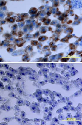CXCL1/GROa/KC/CINC-1 was detected in perfusion fixed frozen sections of rat liver using Rat CXCL1/GROa/KC/CINC-1 Antigen Affinity-purified Polyclonal Antibody (Catalog # AF-515-NA) at 15 µg/mL overnight at 4 °C. Tissue was stained using the Anti-Goat HRP-DAB Cell & Tissue Staining Kit (brown; Catalog # CTS008) and counterstained with hematoxylin (blue). Lower panel shows a lack of labeling if primary antibodies are omitted and tissue is stained only with secondary antibody followed by incubation with detection reagents. View our protocol for Chromogenic IHC Staining of Frozen Tissue Sections.