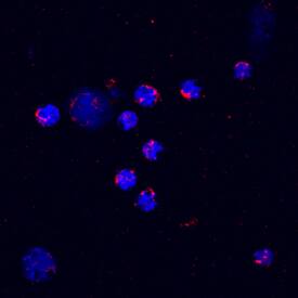 CXCL2/GRO beta /MIP-2/CINC-3 was detected in immersion fixed mouse splenocytes stimulated with LPS and monensin using Mouse CXCL2/GRO beta /MIP-2/CINC-3 Biotinylated Antigen Affinity-purified Polyclonal Antibody (Catalog # BAF452) at 10 µg/mL for 3 hours at room temperature. Cells were stained using the NorthernLights™ 557-conjugated Streptavidin (red; Catalog # NL999) and counterstained with DAPI (blue). Specific staining was localized to cytoplasm. View our protocol for Fluorescent ICC Staining of Non-adherent Cells.