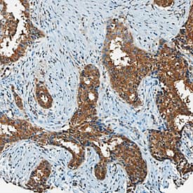 Immunohistochemistry CXCL5/ENA-78 Antibody [Unconjugated]