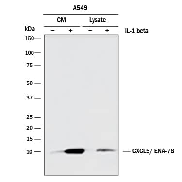 Western Blot CXCL5/ENA-78 Antibody [Unconjugated]