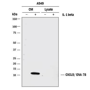 Western blot shows lysates of conditioned media (CM) and lysates from A549 human lung carcinoma cell line untreated (-) or treated (+) with human IL-1 beta for 24 hours. PVDF membrane was probed with 2 µg/mL of Mouse Anti-Human CXCL5/ENA-78 Monoclonal Antibody (Catalog # MAB2541) followed by HRP-conjugated Anti-Mouse IgG Secondary Antibody (Catalog # HAF007). A specific band was detected for CXCL5/ENA-78 at approximately 10 kDa (as indicated). This experiment was conducted under reducing conditions and using Immunoblot Buffer Group 1.
