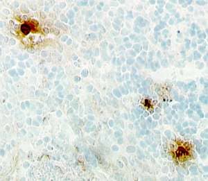 Immunohistochemistry CXCL8/IL-8 Antibody [Unconjugated]