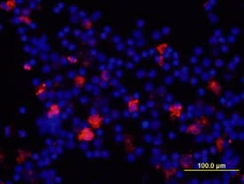 IL-8/CXCL8 was detected in immersion fixed human peripheral blood mononuclear cells (PBMCs) using Mouse Anti-Human IL-8/CXCL8 Monoclonal Antibody (Catalog # MAB208) at 10 µg/mL for 3 hours at room temperature. Cells were stained using the NorthernLights™ 557-conjugated Anti-Mouse IgG Secondary Antibody (red; Catalog # NL007) and counterstained with DAPI (blue). View our protocol for Fluorescent ICC Staining of Non-adherent Cells.
