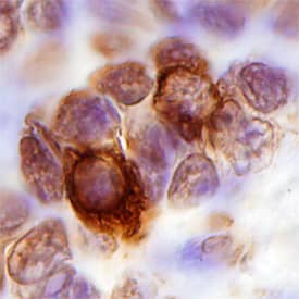 CXCR3 was detected in immersion fixed paraffin-embedded sections of human tonsil using Human CXCR3 Monoclonal Antibody (Catalog # MAB160) at 3 µg/mL overnight at 4 °C. Tissue was stained using the Anti-Mouse HRP-DAB Cell & Tissue Staining Kit (brown; CTS002) and counter-stained with hematoxylin (blue). View our protocol for Chromogenic IHC Staining of Paraffin-embedded Tissue Sections.