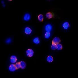 CXCR4 was detected in immersion fixed mouse splenocytes using Rat Anti-Mouse CXCR4 Monoclonal Antibody (Catalog # MAB21651R) at 1 µg/mL for 3 hours at room temperature. Cells were stained using the NorthernLights™ 557-conjugated Anti-Rat IgG Secondary Antibody (red; Catalog # NL013) and counterstained with DAPI (blue). Specific staining was localized to cell surfaces and cytoplasm. View our protocol for Fluorescent ICC Staining of Non-adherent Cells.