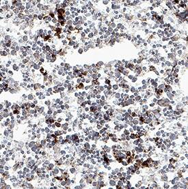 CXCR4 was detected in perfusion fixed frozen sections of mouse spleen using Rat Anti-Mouse CXCR4 Monoclonal Antibody (Catalog # MAB21651R) at 15 µg/mL overnight at 4 °C. Tissue was stained using the Anti-Rat HRP-DAB Cell & Tissue Staining Kit (brown; Catalog # CTS017) and counterstained with hematoxylin (blue). Specific staining was localized to splenocytes. View our protocol for Chromogenic IHC Staining of Frozen Tissue Sections.