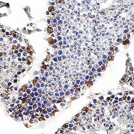 CXCR4 was detected in perfusion fixed frozen sections of mouse testis using Rat Anti-Mouse CXCR4 Monoclonal Antibody (Catalog # MAB21651R) at 15 µg/mL overnight at 4 °C. Tissue was stained using the Anti-Rat HRP-DAB Cell & Tissue Staining Kit (brown; Catalog # CTS017) and counterstained with hematoxylin (blue). Specific staining was localized to cell membranes in sperm cells. View our protocol for Chromogenic IHC Staining of Frozen Tissue Sections.