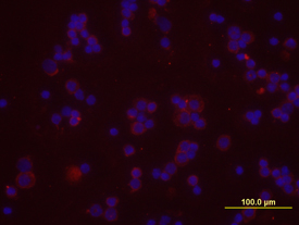 CXCR4 was detected in immersion fixed mouse splenocytes using 10 µg/mL Rat Anti-Mouse CXCR4 Monoclonal Antibody (Catalog # MAB21651) for 3 hours at room temperature. Cells were stained with the NorthernLights™ 557-conjugated Anti-Rat IgG Secondary Antibody (red; Catalog # NL013) and counterstained with DAPI (blue). View our protocol for Fluorescent ICC Staining of Non-adherent Cells.
