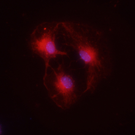 CXCR4 was detected in immersion fixed mouse neural progenitor cells using 10 µg/mL Rat Anti-Mouse CXCR4 Monoclonal Antibody (Catalog # MAB21651) for 3 hours at room temperature. Cells were stained with the NorthernLights™ 557-conjugated Anti-Rat IgG Secondary Antibody (red; Catalog # NL013) and counterstained with DAPI (blue). View our protocol for Fluorescent ICC Staining of Cells on Coverslips.