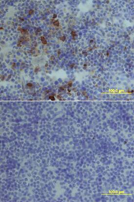 CXCR4 was detected in immersion fixed frozen sections of mouse spleen using Rat Anti-Mouse CXCR4 Monoclonal Antibody (Catalog # MAB21651) at 15 µg/mL overnight at 4 °C. Tissue was stained using the Anti-Rat HRP-DAB Cell & Tissue Staining Kit (brown; Catalog # CTS017) and counterstained with hematoxylin (blue). Lower panel shows a lack of labeling if primary antibodies are omitted and tissue is stained only with secondary antibody followed by incubation with detection reagents. View our protocol for Chromogenic IHC Staining of Frozen Tissue Sections.