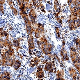 Immunohistochemistry CXCR7/RDC-1 Antibody (358426) [Unconjugated]
