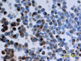 Immunohistochemistry CXCR7/RDC-1 Antibody (358426) [Unconjugated]