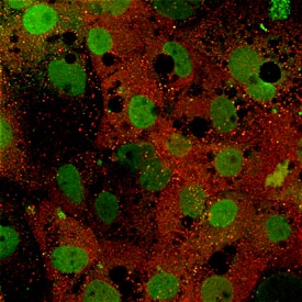 Immunocytochemistry CYP7A1 Antibody (946902) [Unconjugated]