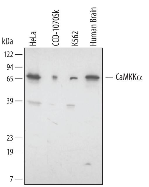 Western Blot CaMKK alpha Antibody [Unconjugated]