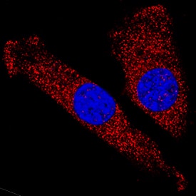 CaM Kinase II was detected in immersion fixed C2C12 mouse myoblast cell line using Mouse Anti-Human/Mouse/Rat CaM Kinase II Pan Specific Monoclonal Antibody (Catalog # MAB7280) at 25 µg/mL for 3 hours at room temperature. Cells were stained using the NorthernLights™ 557-conjugated Anti-Mouse IgG Secondary Antibody (red; Catalog # NL007) and counterstained with DAPI (blue). Specific staining was localized to cytoplasm. View our protocol for Fluorescent ICC Staining of Cells on Coverslips.