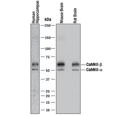Western blot shows lysates of human brain (hippocampus) tissue, mouse brain tissue, and rat brain tissue. PVDF membrane was probed with 1 µg/mL of Mouse Anti-Human/Mouse/Rat CaM Kinase II Pan Specific Monoclonal Antibody (Catalog # MAB7280) followed by HRP-conjugated Anti-Mouse IgG Secondary Antibody (Catalog # HAF018). A specific band was detected for CaM Kinase II at approximately 50 and 60 kDa (as indicated). This experiment was conducted under reducing conditions and using Immunoblot Buffer Group 1.