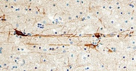 CaM Kinase IId was detected in immersion fixed paraffin-embedded sections of human brain (cerebral cortex) using 15 µg/mL Sheep Anti-Human CaM Kinase IId Antigen Affinity-purified Polyclonal Antibody (Catalog # AF4176) overnight at 4 °C. Tissue was stained with the Anti-Sheep HRP-DAB Cell & Tissue Staining Kit (brown; Catalog # CTS019) and counter-stained with hematoxylin (blue). View our protocol for Chromogenic IHC Staining of Paraffin-embedded Tissue Sections.