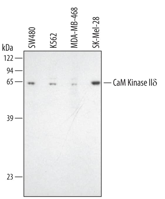 Western blot shows lysates of SW480 human colorectal adenocarcinoma cell line, K562 human chronic myelogenous leukemia cell line, MDA-MB-468 human breast cancer cell line, and SK-Mel-28 human malignant melanoma cell line. PVDF membrane was probed with 2 µg/mL of Sheep Anti-Human CaM Kinase IId Antigen Affinity-purified Polyclonal Antibody (Catalog # AF4176) followed by HRP-conjugated Anti-Sheep IgG Secondary Antibody (Catalog # HAF016). A specific band was detected for CaM Kinase IId at approximately 56 kDa (as indicated). This experiment was conducted under reducing conditions and using Immunoblot Buffer Group 1.
