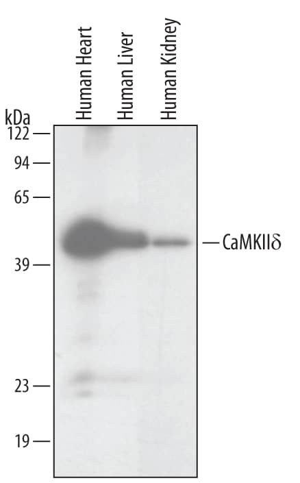 Western blot shows lysates of human heart, liver and kidney tissue. PVDF membrane was probed with 1 µg/mL of Human/Mouse/Rat CaM Kinase IId Monoclonal Antibody (Catalog # MAB4176) followed by HRP-conjugated Anti-Mouse IgG Secondary Antibody (Catalog # HAF007). Specific bands were detected for CaM Kinase IId isoforms at approximately 50 to 54 kDa (as indicated). This experiment was conducted under reducing conditions and using Immunoblot Buffer Group 3.