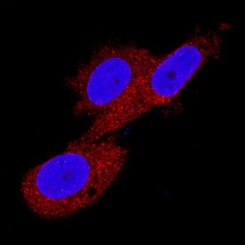 CaM Kinase II was detected in immersion fixed PC-3 human prostate cancer cell line using Mouse Anti-Human/Mouse/Rat CaM Kinase II Pan Specific Monoclonal Antibody (Catalog # MAB7280) at 8 µg/mL for 3 hours at room temperature. Cells were stained using the NorthernLights™ 557-conjugated Anti-Mouse IgG Secondary Antibody (red; Catalog # NL007) and counterstained with DAPI (blue). Specific staining was localized to cytoplasm. View our protocol for Fluorescent ICC Staining of Cells on Coverslips.